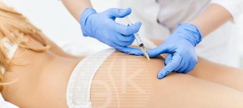 Биоревитализация лица и тела. Что представляет собой процедура биоревитализации 05